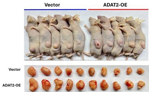 trna-modification-promotes-cancer